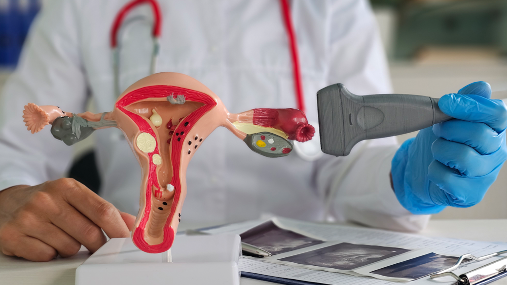 ginecologia-segura-Aquamed