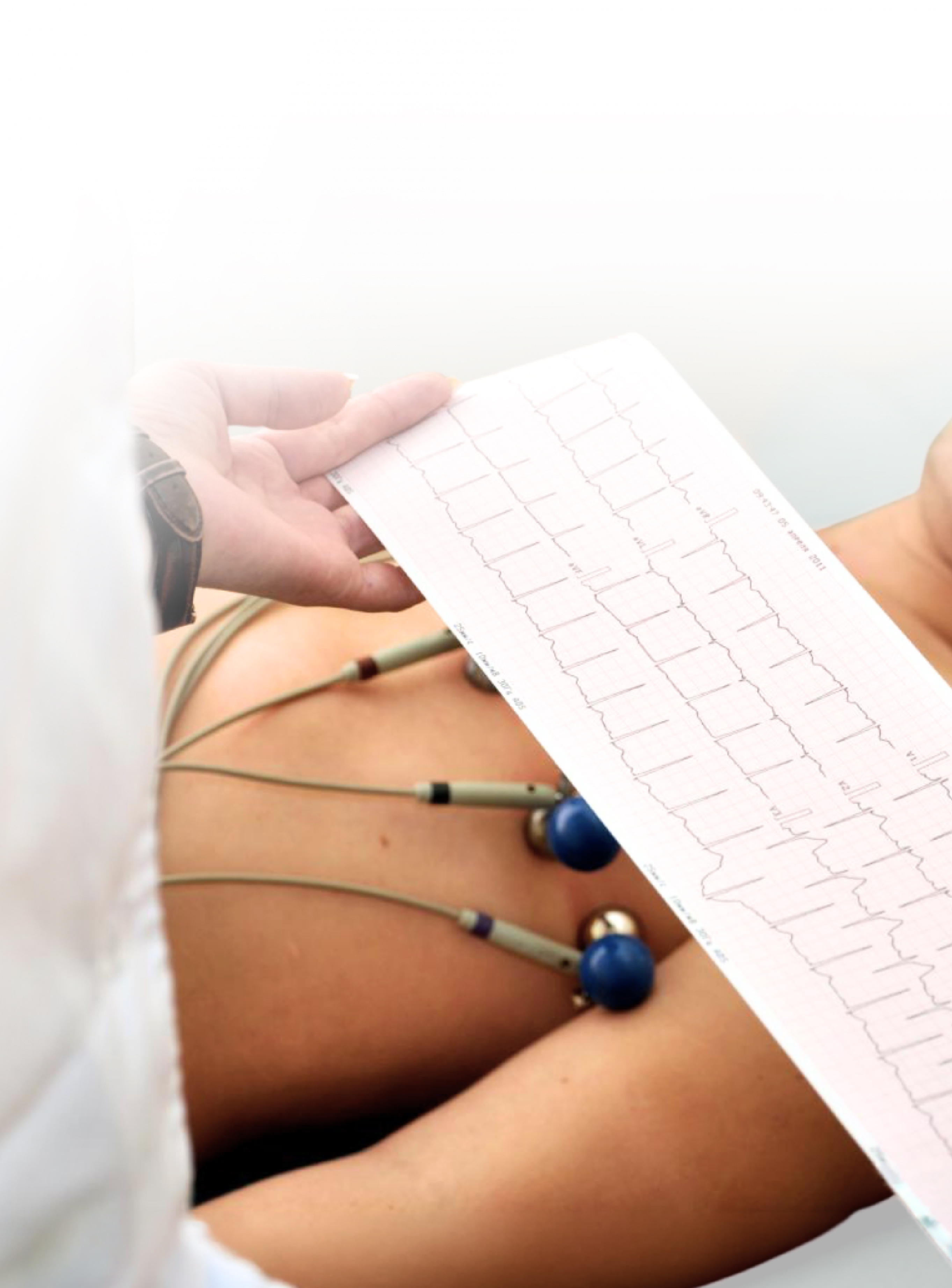 Electrocardiograma en reposo en Aquamed