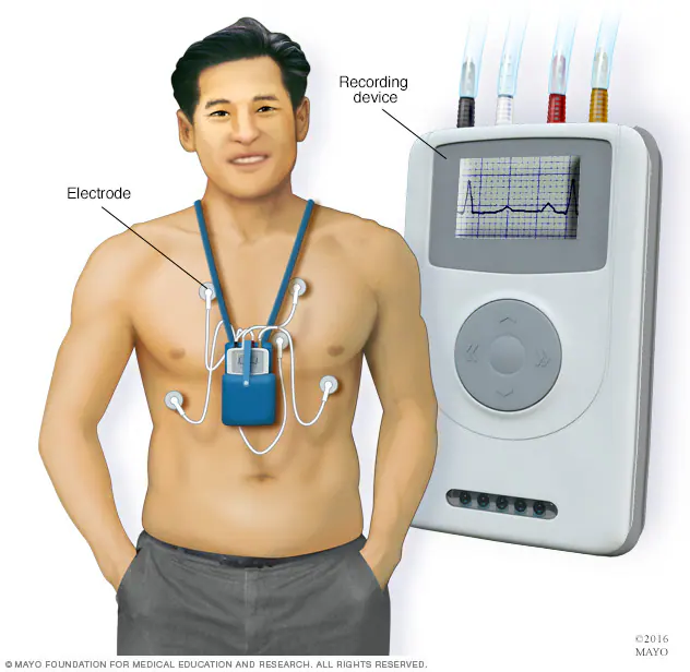 Holter cardíaco de 24 o 48 horas