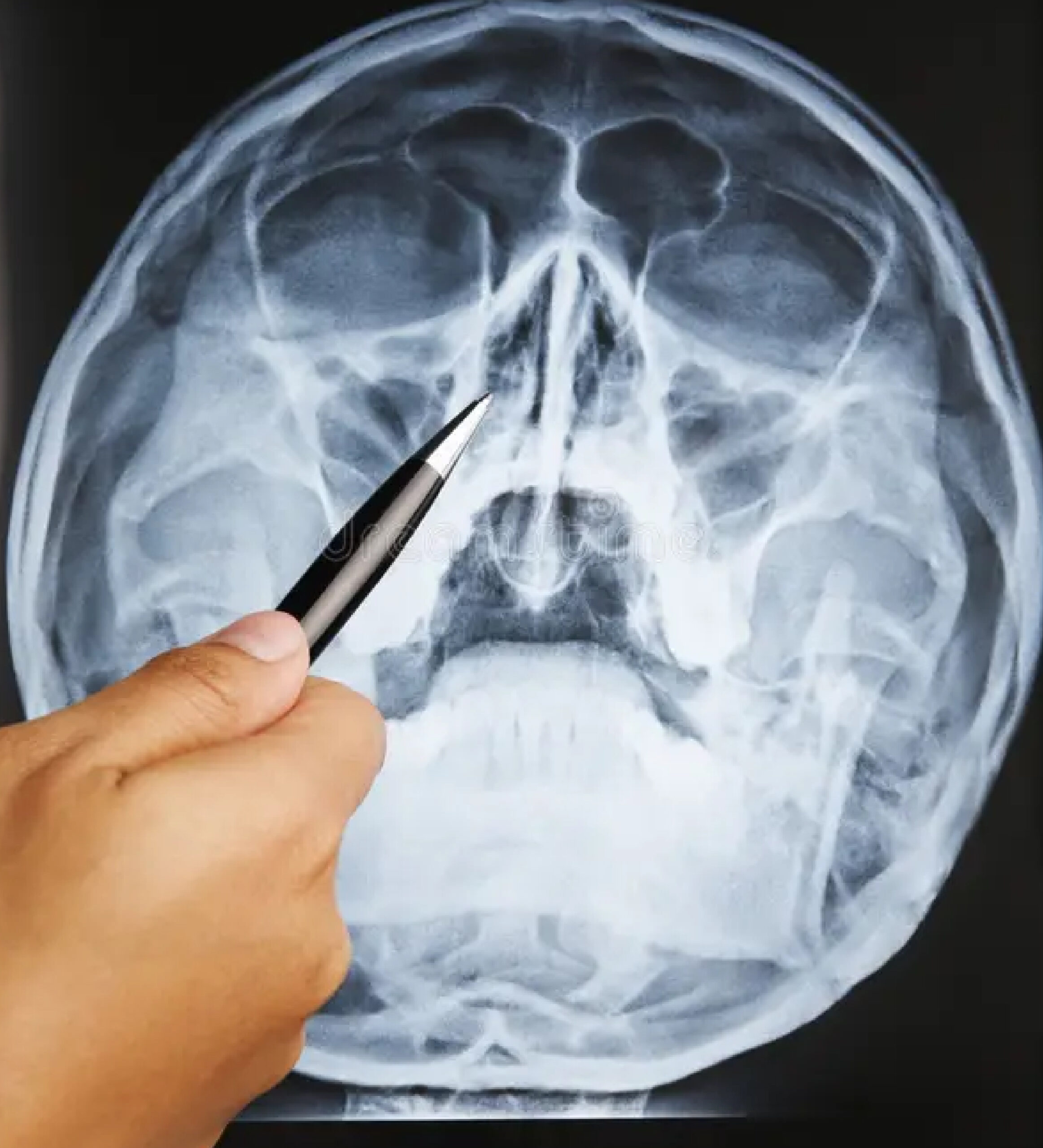 Radiografía de cavidades perinasales y estructuras de la cara