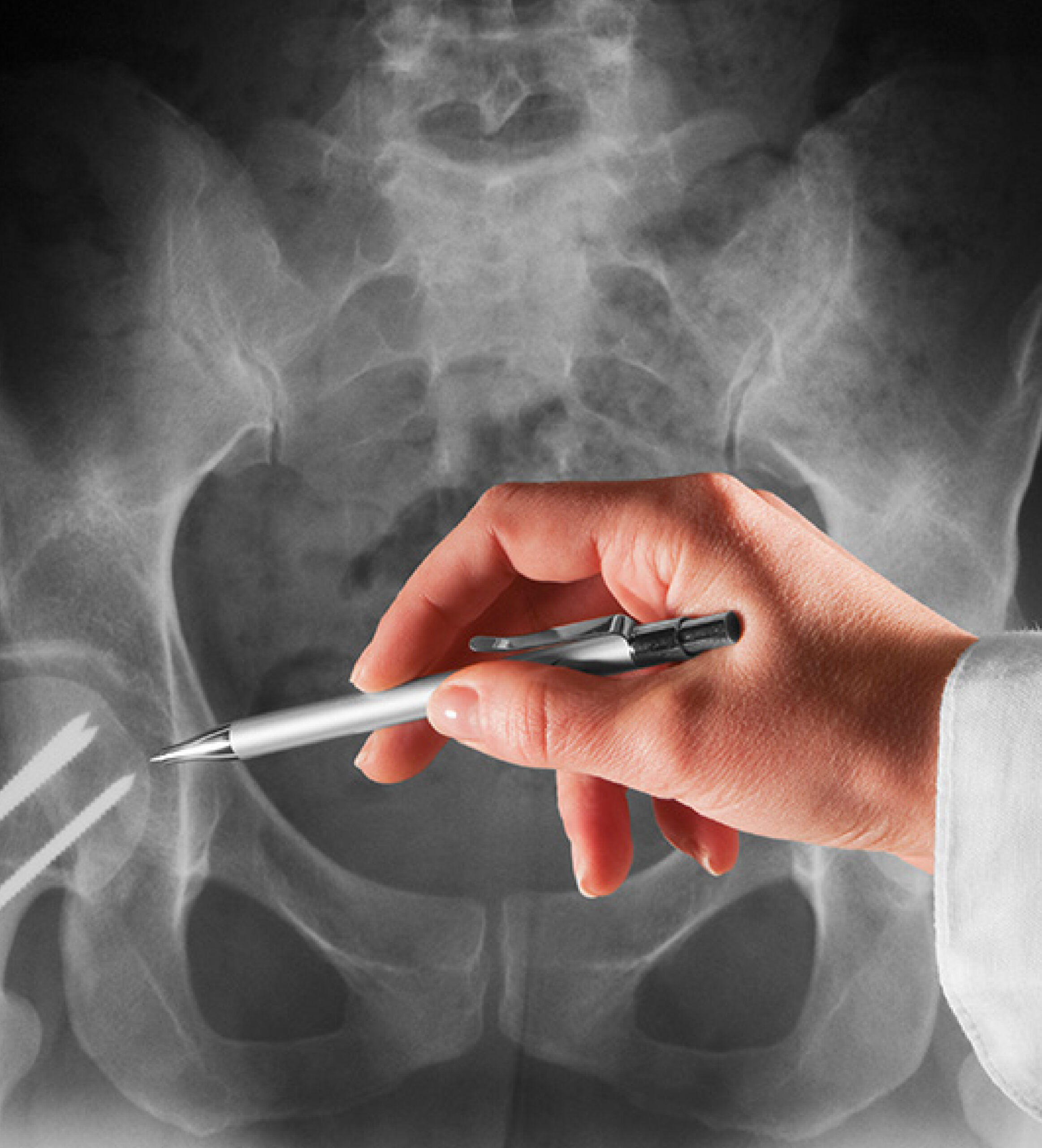 Radiografía de pelvis con proyecciones especiales